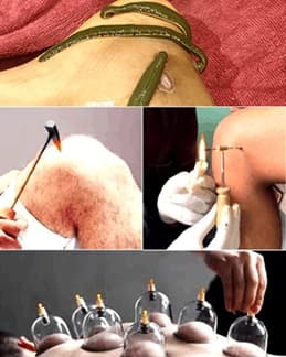 Anushastra Treatments in Ayurveda